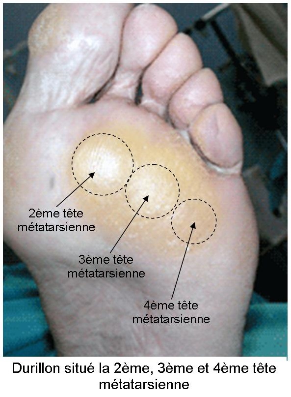 Semelle plante online des pieds